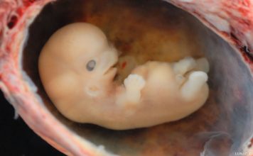 Aborted fetus cells