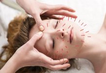The Power of Acupuncture: Understanding This Ancient Healing Practice