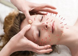 The Power of Acupuncture: Understanding This Ancient Healing Practice