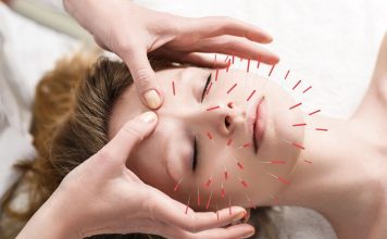The Power of Acupuncture: Understanding This Ancient Healing Practice