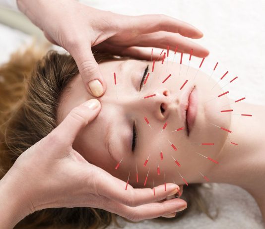 The Power of Acupuncture: Understanding This Ancient Healing Practice