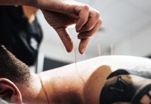 The Science of Acupuncture: Understanding the Health Benefits of This Traditional Chinese Medicine Practice