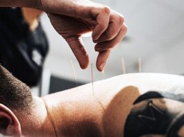 The Science of Acupuncture: Understanding the Health Benefits of This Traditional Chinese Medicine Practice