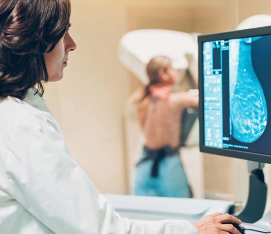 Artificial Intelligence Outperforms Doctors in Diagnosing Breast Cancer