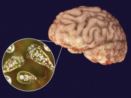 Amoeba eating brain