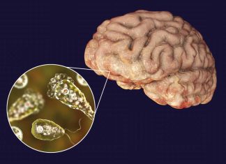 Amoeba eating brain