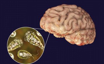 Amoeba eating brain