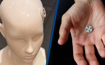 Scientists Develop First-Ever Brain Implant to Treat Depression
