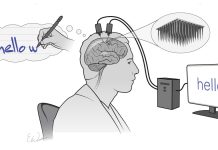 Brain thoughts implant lets man with locked-in syndrome communicate with the world