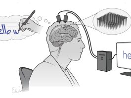 Brain thoughts implant lets man with locked-in syndrome communicate with the world