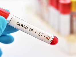 Covid blood test