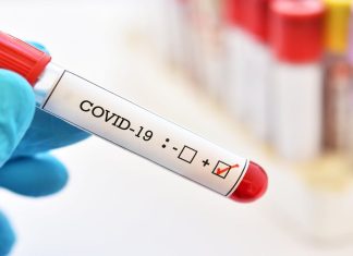 Covid blood test