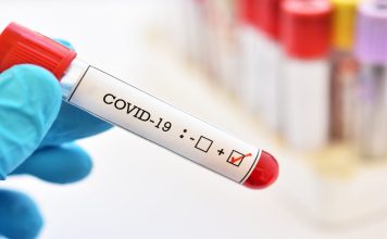 Covid blood test