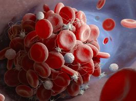 The Discovery of Platelets: How Blood Clots and Prevents Bleeding