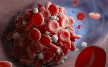 The Discovery of Platelets: How Blood Clots and Prevents Bleeding