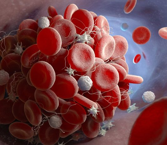 The Discovery of Platelets: How Blood Clots and Prevents Bleeding