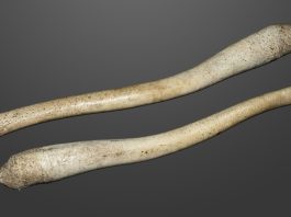 Do dicks have bones