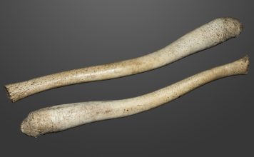 Do dicks have bones