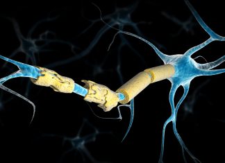 Epstein barr virus multiple sclerosis