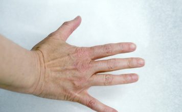 Finger length