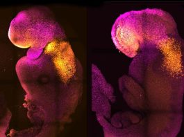 Scientists Create First Synthetic Embryo-Like Structure