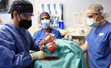 Genetically altered pig heart transplant