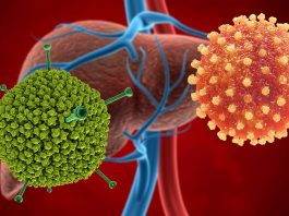 Mysterious hepatitis cases