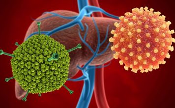 Mysterious hepatitis cases