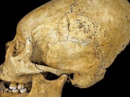 Paracas skulls