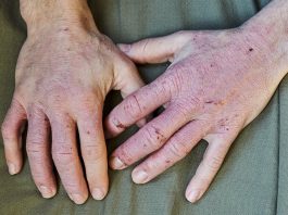 The Science of Skin Health: Understanding Common Skin Conditions and Treatment Options