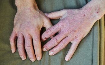 The Science of Skin Health: Understanding Common Skin Conditions and Treatment Options